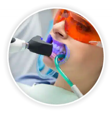 1506352360 8629258 389x390 teeth whitening - Best Cosmetic and General Dentistry In Bakersfield