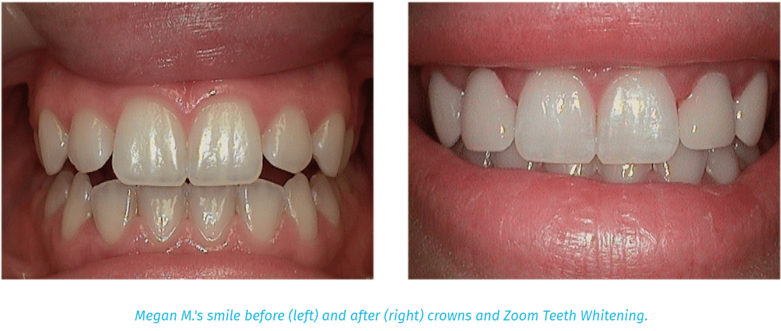 Teeth Image - Best Cosmetic and General Dentistry In Bakersfield
