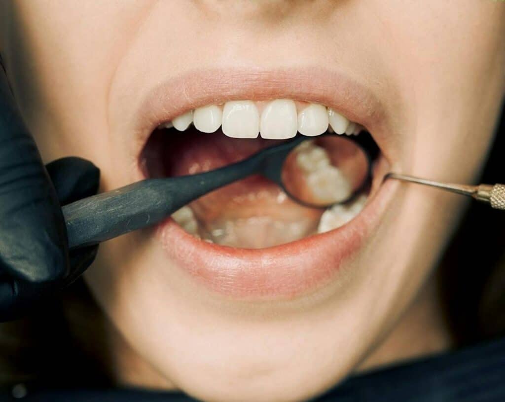 teeth