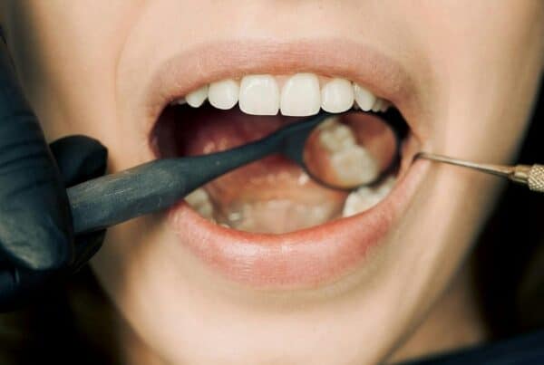teeth