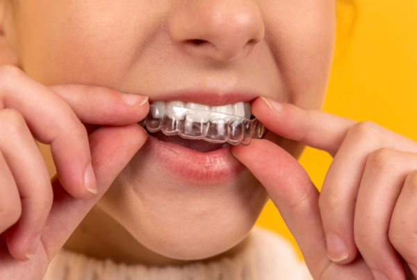 Invisalign vs. Braces for Adults: Which One Actually Fits Your Life 2 invisalign