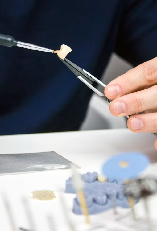 The Real Difference Between a Dental Crown and a Veneer and How to Know Which One You Need 1 dental crown