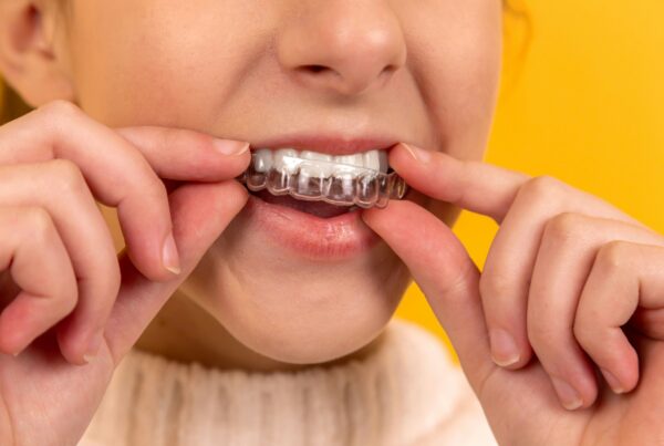 Invisalign