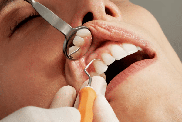 dental bonding