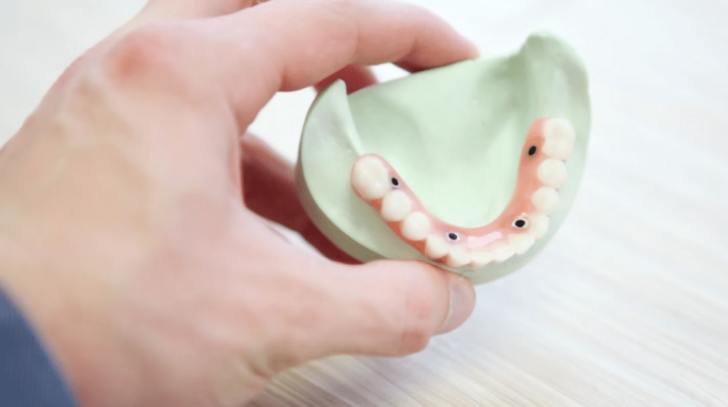 dental bridge