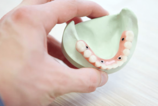 dental bridge